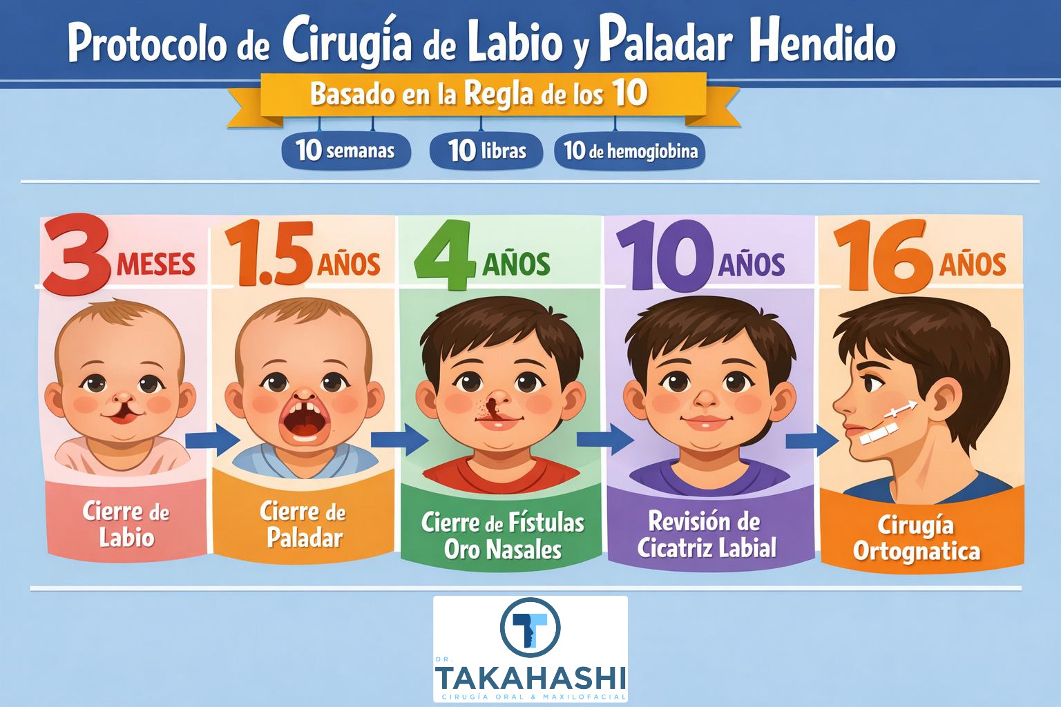 Labio leporino y paladar hendido - Dr. Carlos Takahashi Labio leporino y paladar hendido - Dr. Carlos Takahashi